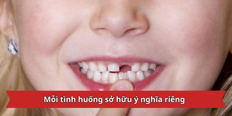 Mỗi tình huống mơ thấy răng rụng đều sở hữu ý nghĩa riêng